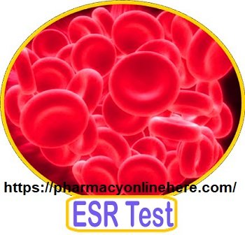 What Is ESR Test Procedure, Importance, Requirements, Normal Levels?